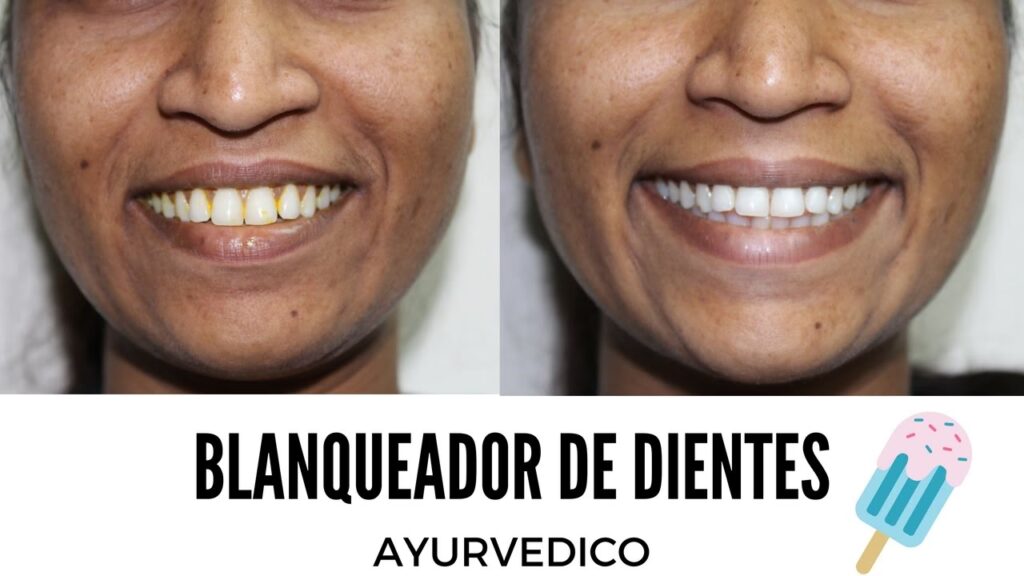 Turismo Dental en India: ¿Una Opción Segura y Real?