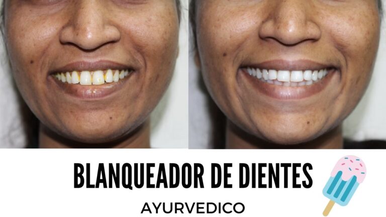 Turismo Dental en India: &iquest;Una Opci&oacute;n Segura y Real?