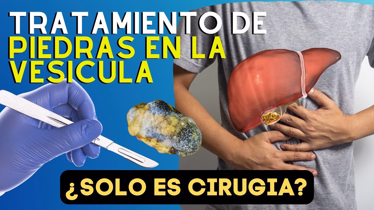 &iquest;Qu&eacute; t&eacute; de hierbas es el mejor para los c&aacute;lculos biliares?